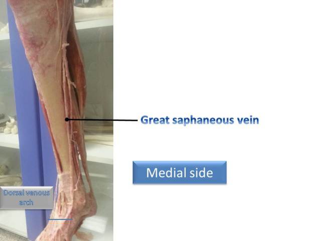 Great saphaneous vein-2