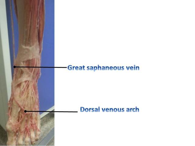 Great saphaneous vein-3