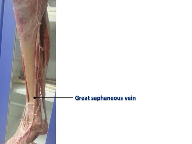 Great saphaneous vein
