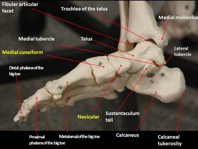 figure-5-bones-of-the-foot-medial-view2