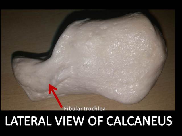 Lateral view of calcaneus