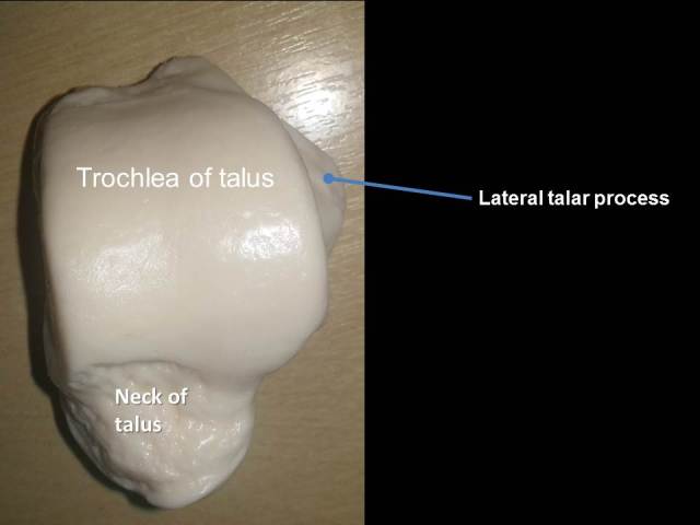 Talus-Superior view