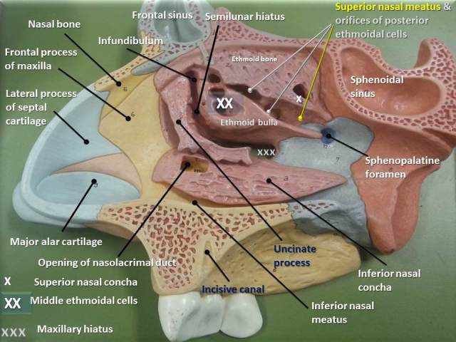 fig-6-nasal-cavity-lateral-wall